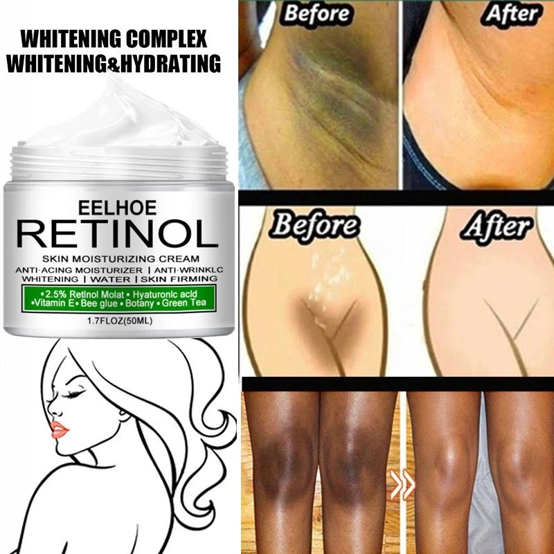 Perfume Zara - Body Whitening Cream Private Parts Underarm