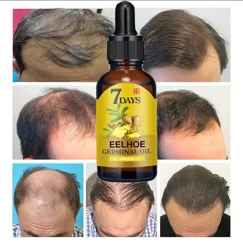 7 Day Fast Hair Growth Oil Gin - Perfume Zara recension och pris