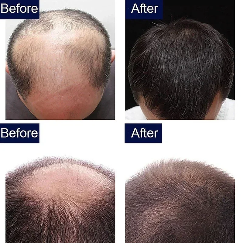 7 Day Fast Hair Growth Oil Gin - Perfume Zara recension och pris